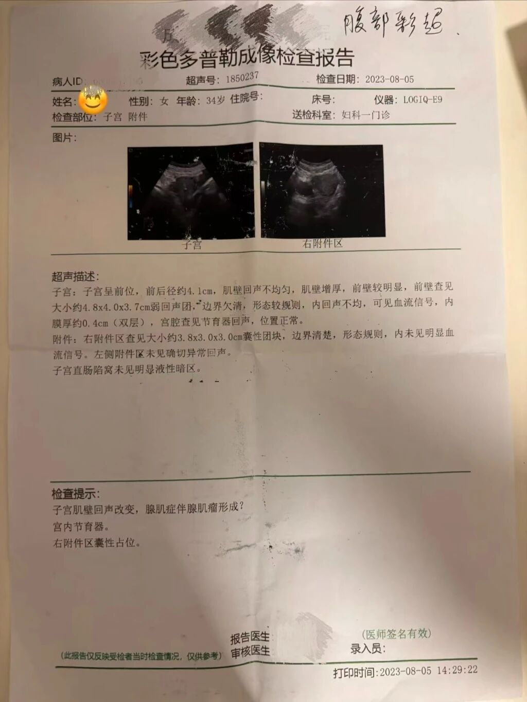 节育环2.jpg