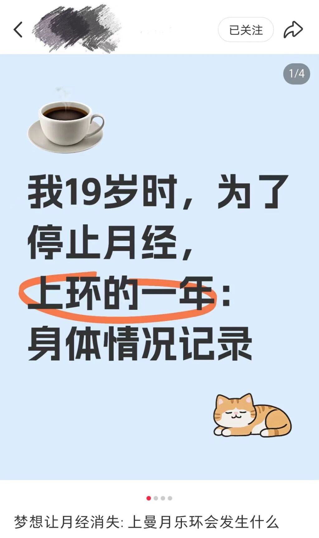 节育环4.jpg